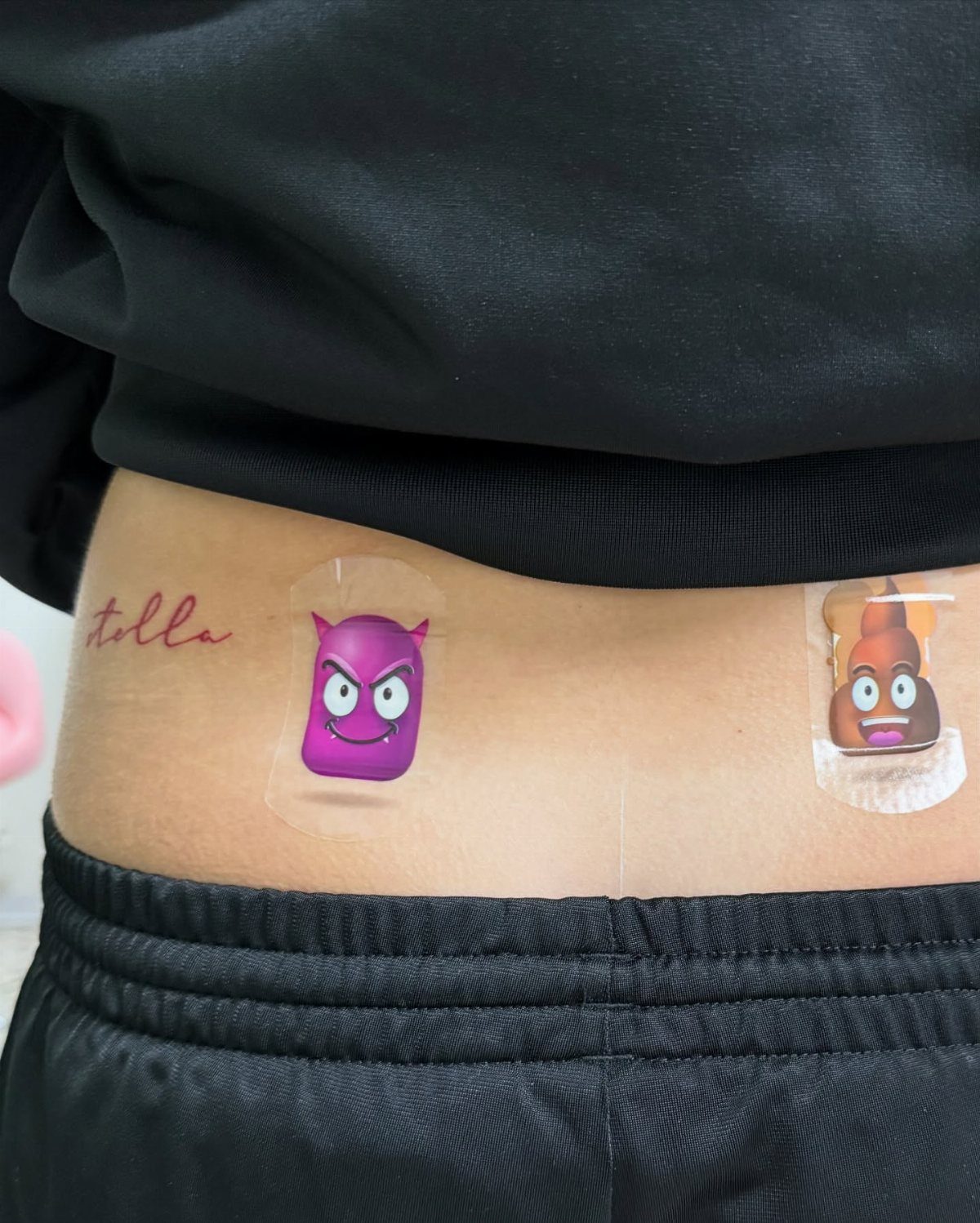 Dermal Piercing for Back Dimples: 7 Ideas and Jewelry 5 Dermal piercings in back dimples covered by cartoon character bandages on lower back.