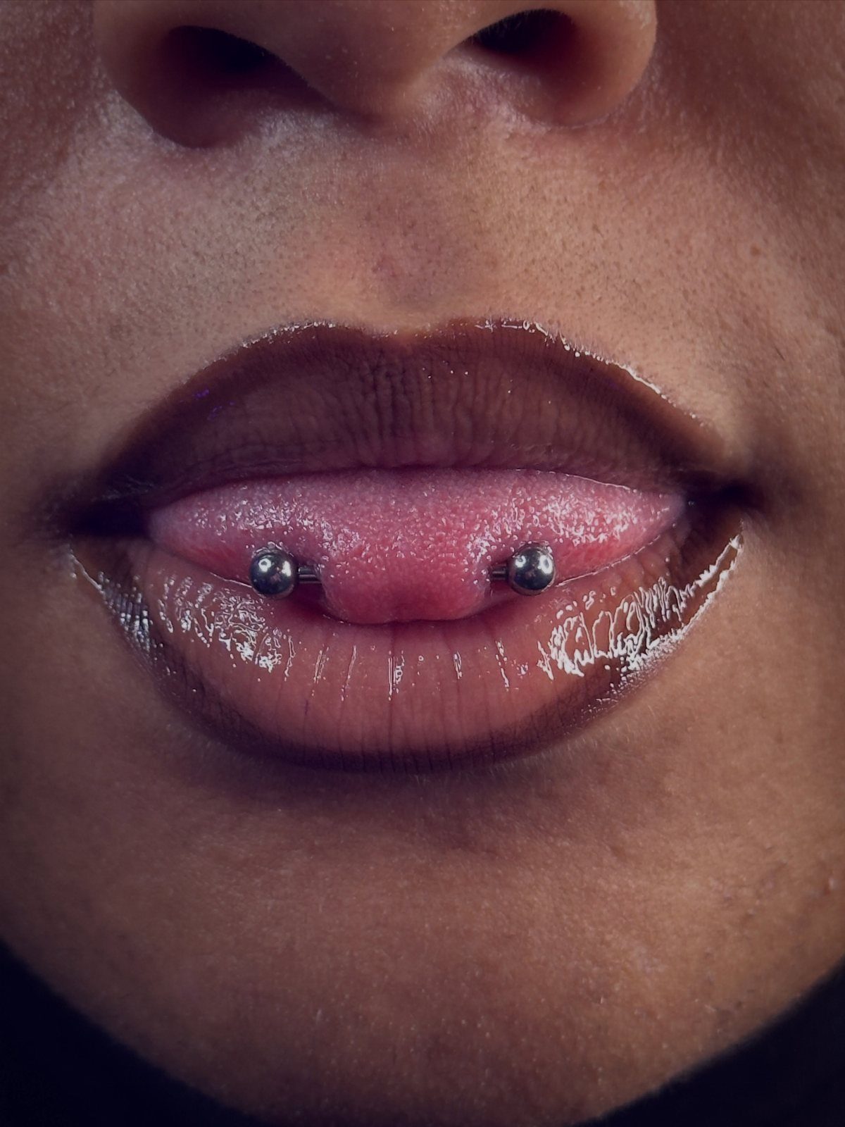 Tongue piercing with silver metal beads on a person's tongue and lips.