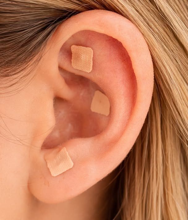 Human ear with three small skin-colored patches hiding ear piercings.
